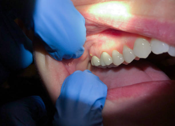 Best Emergency Orthodontic Repairs in New Ellenton, SC