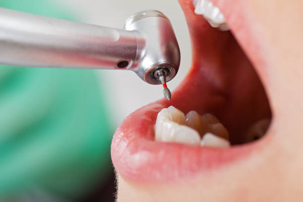 Best Emergency Treatment for Toothache in New Ellenton, SC